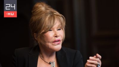 Jocelyn Wildenstein, azaz a „macskanő” megmutatta, hogy nézett ki arcplasztikái előtt